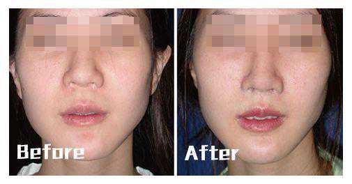 400元赌资牵出数十亿元大案，90后赌徒半年狂输3000万